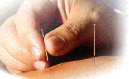 Painless Acupuncture (Drug / Alcohol / Smock addiction control in Torrance and Fullerton)